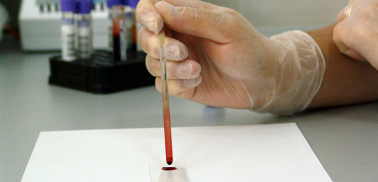 Blood Test