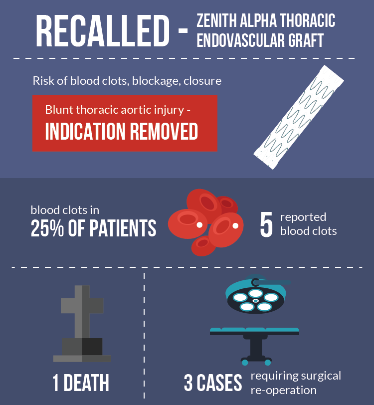 Zenith Graft Recall Infographic