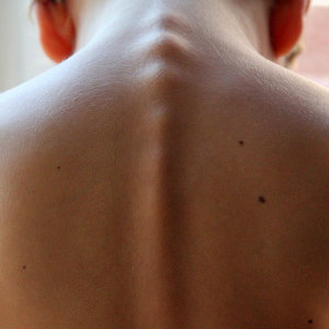 spinal column young man